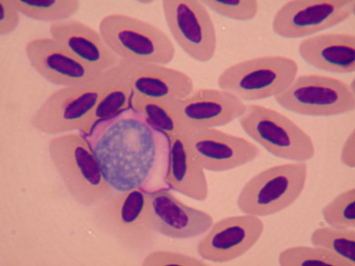 Leukocytozoon in Bicknell's Thrush blood. / © VCE