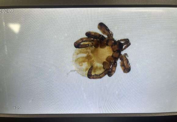 Tick nymph under the microscope 
